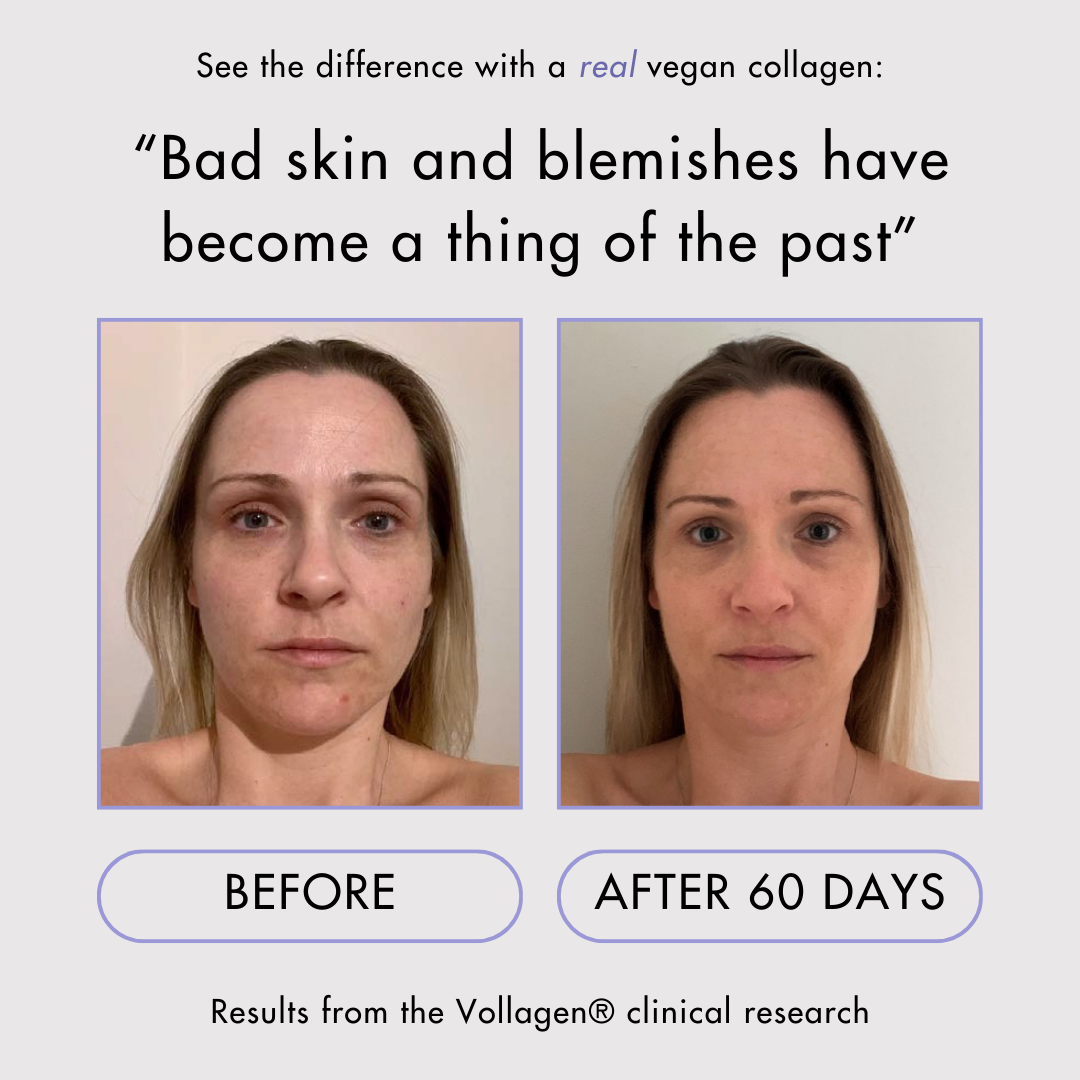 Vegan Collagen